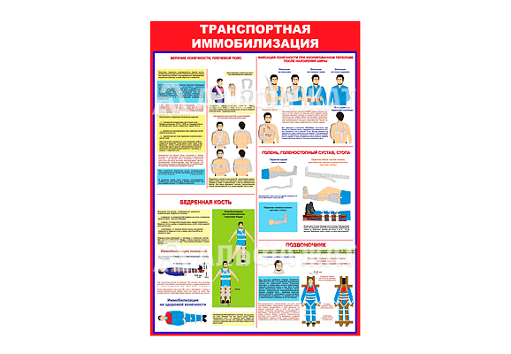 Стенд информационный «Транспортная иммобилизация»